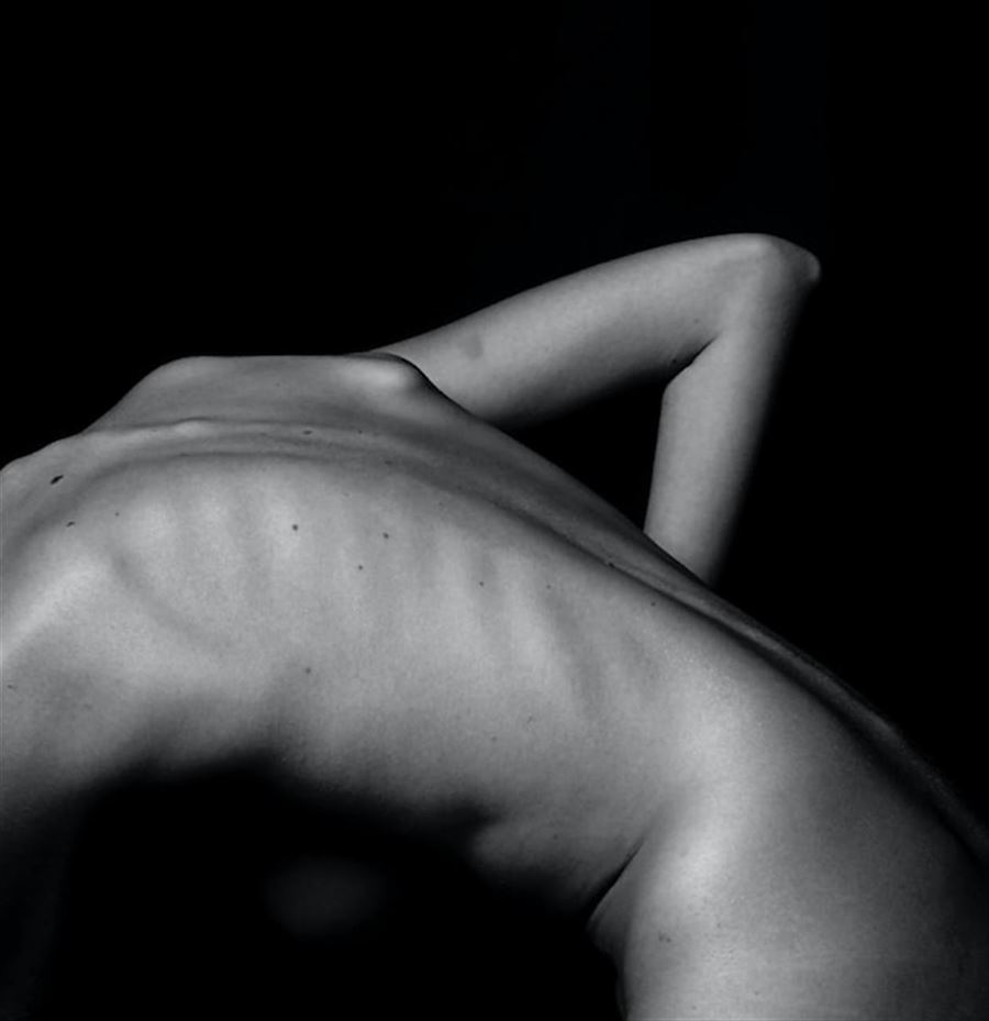 Behandling af lændesmerter